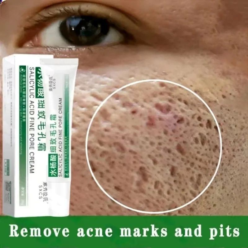 Korean Lifestyle Products - Krim Pembersih Pori Asam Salisilat Mengecilkan