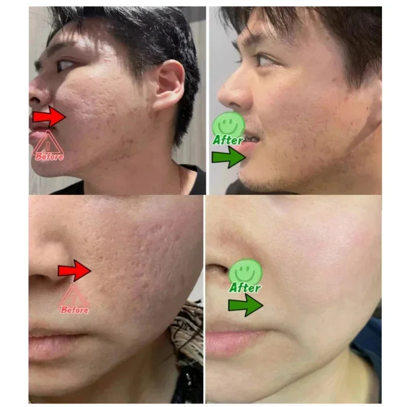 Krim Pembersih Pori Asam Salis - Korean Lifestyle Products ulasan dan harga