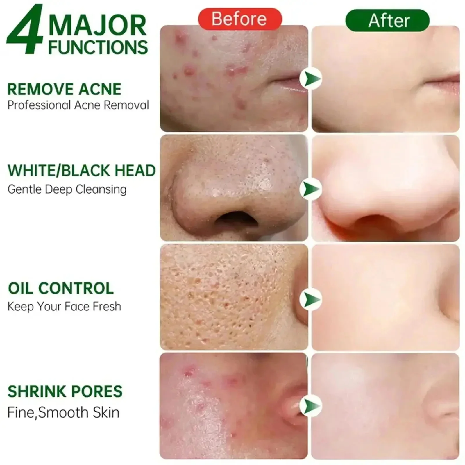 Krim Pembersih Pori Asam Salis - Korean Lifestyle Products ulasan dan harga