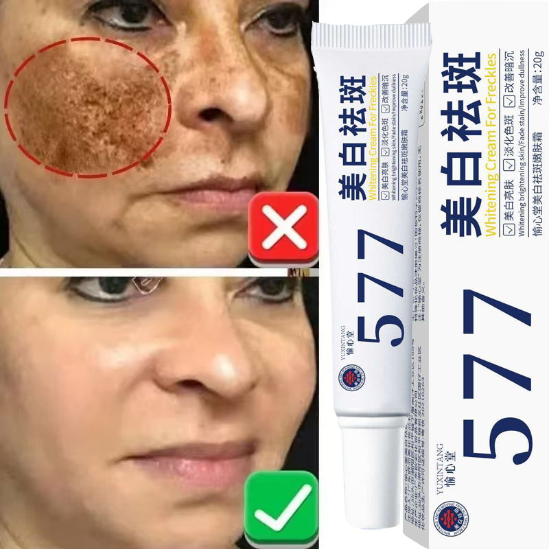Krim Pemutih Penghilang Flek M - Korean Lifestyle Products ulasan dan harga