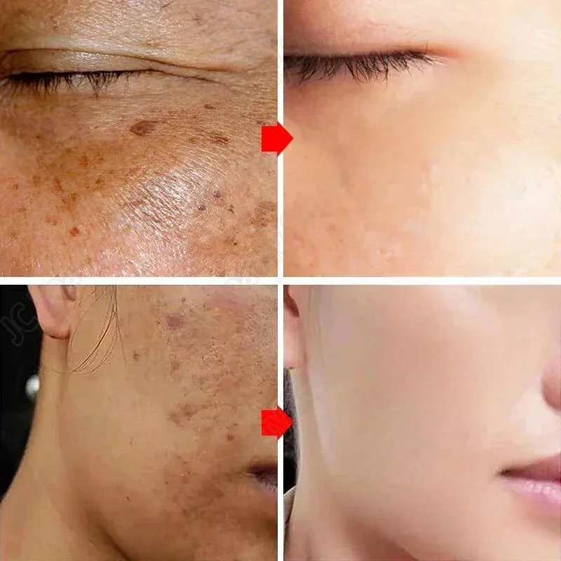 Krim Pemutih Penghilang Flek M - Korean Lifestyle Products ulasan dan harga