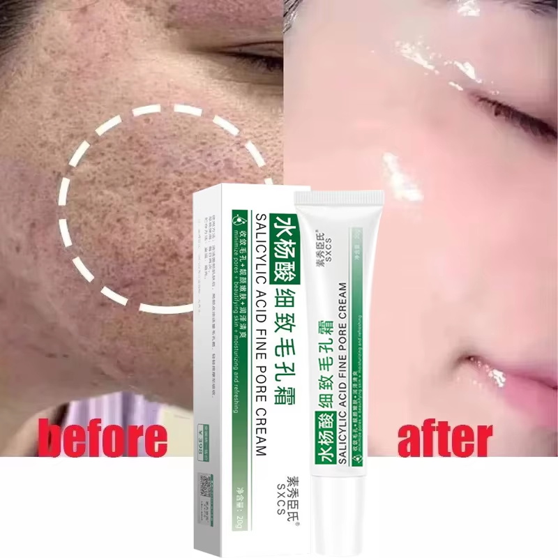 Krim Pengecil Pori Asam Salisi - Korean Lifestyle Products ulasan dan harga