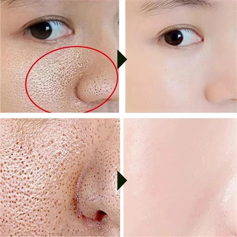 Krim Pengecil Pori Asam Salisi - Korean Lifestyle Products ulasan dan harga